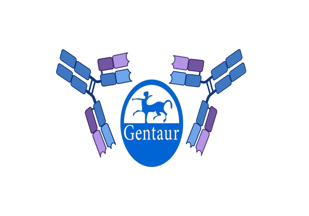  Rheumatoid Factors, rapid test for detection of rheumatoid factor in whole blood, serum or plasma, t...